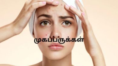 முகப்பருக்கள்