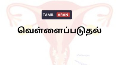 வெள்ளைப்படுதல்