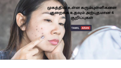 முகத்தில் உள்ள கரும்புள்ளிகளை குறைக்க உதவும் அற்புதமான 4 குறிப்புகள்