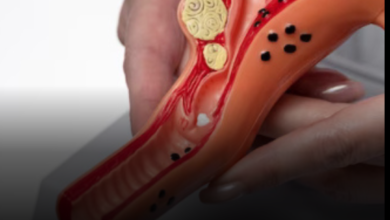 கருப்பை நீர்க்கட்டி: ஆரம்ப கட்ட அறிகுறிகள் என்ன?