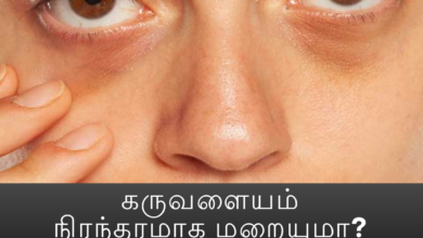 கருவளையம்