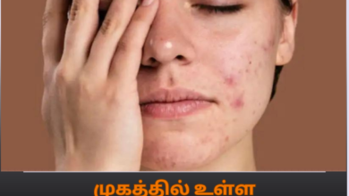 முகத்தில்