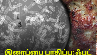 ஃபுட் பாய்சனின் அறிகுறிகள்