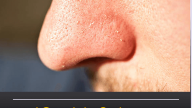 வைட்ஹெட்ஸ் பிரச்சனை