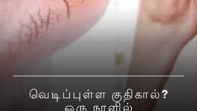 வெடிப்புள்ள குதிகால்
