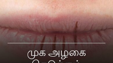 முக அழகை கெடுக்கும் உதடு வெடிப்பு