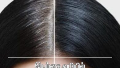 இளநரை