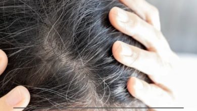 நரைமுடி