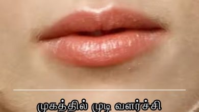 முகத்தில் முடி