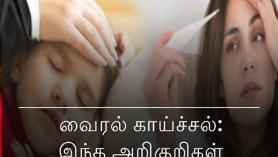 வைரல் காய்ச்சல்