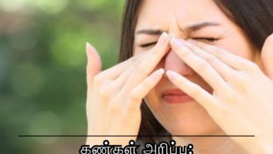 கண்கள் அரிப்பு