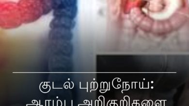 குடல் புற்றுநோய்