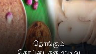 தொங்கும் தொப்பை