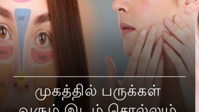 முகத்தில் பருக்கள்