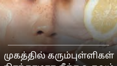 கரும்புள்ளிகள்