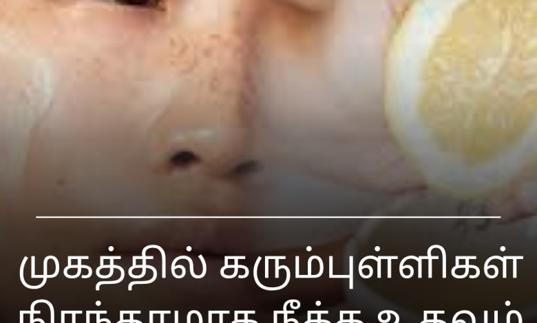 கரும்புள்ளிகள்