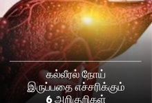 கல்லீரல் நோய்