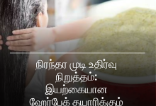 நிரந்தர முடி உதிர்வு