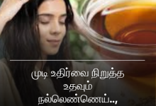 முடி உதிர்வை